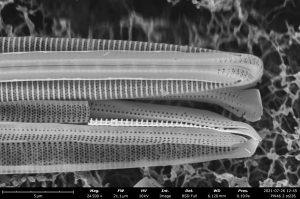 This potentially new diatom species discovered by University of Guam student Britney Sison
